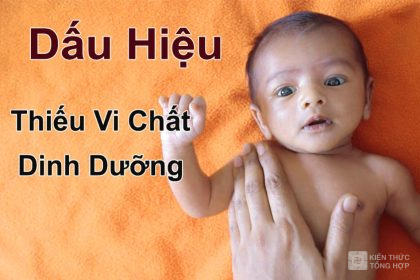 Dấu hiệu thiếu vi chất dinh dưỡng ở trẻ em