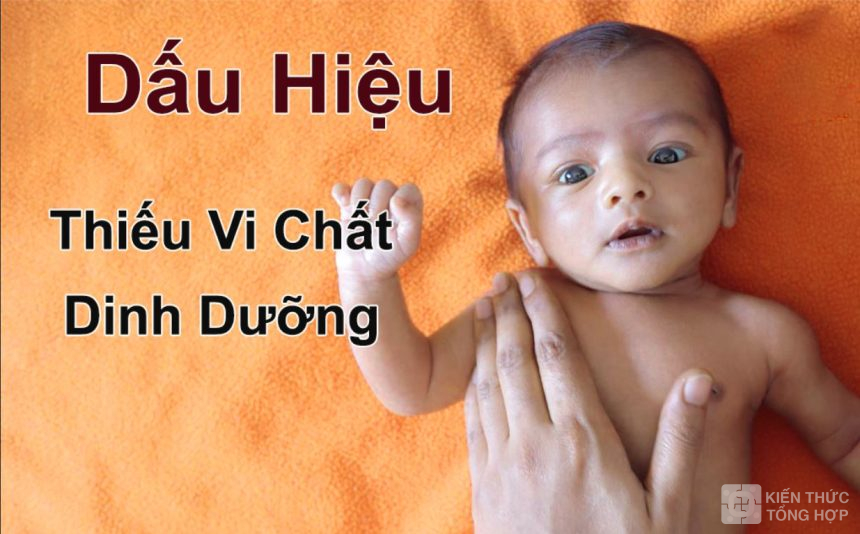 Dấu hiệu thiếu vi chất dinh dưỡng ở trẻ em