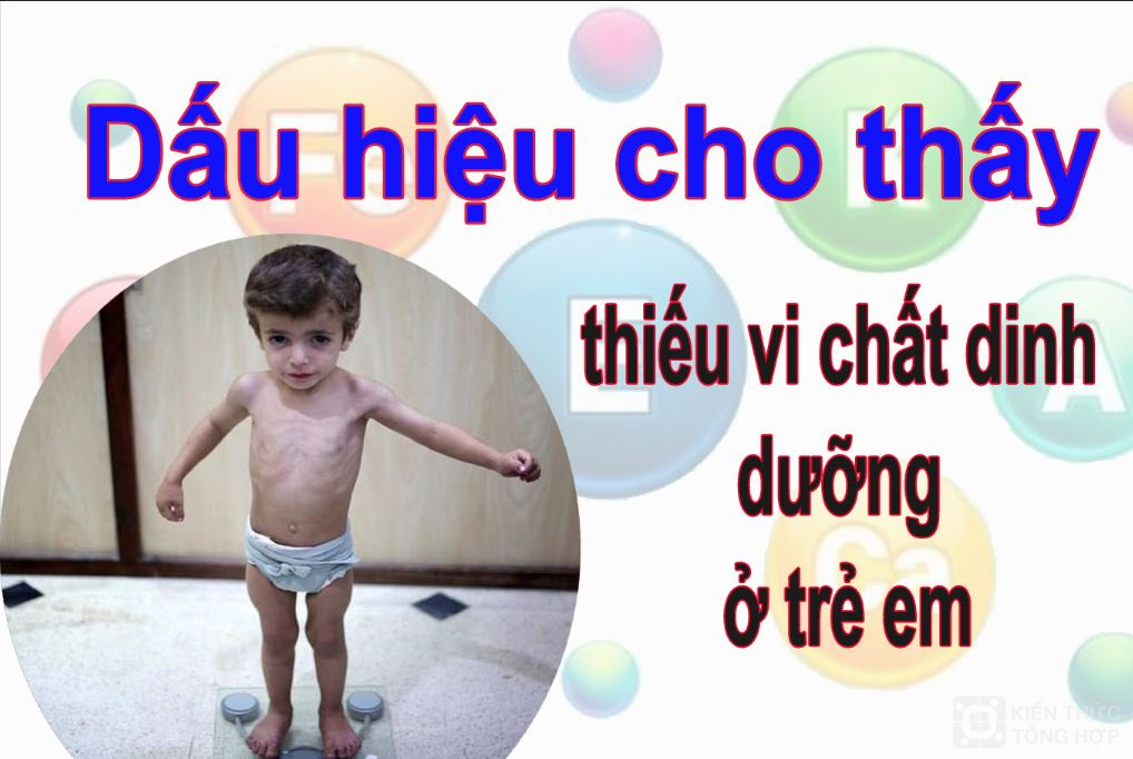 dấu hiệu cho thấy thiếu vi chất dinh dưỡng ở trẻ em