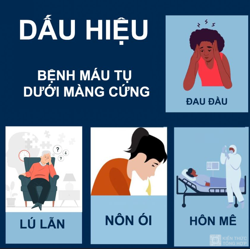 Dấu hiệu bệnh máu tụ dưới màng cứng