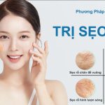 Các phương pháp trị sẹo rỗ