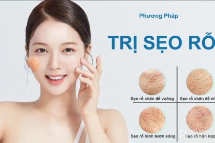 Các phương pháp trị sẹo rỗ