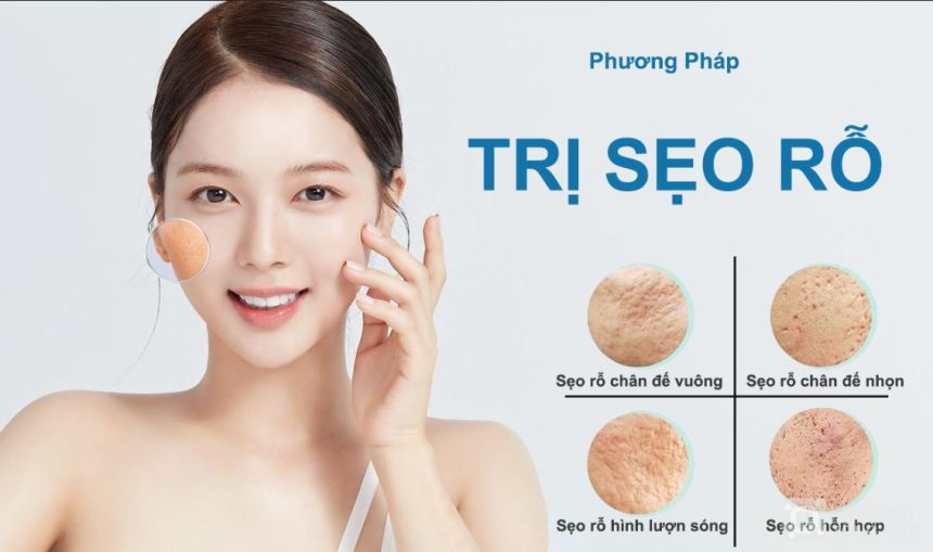 Các phương pháp trị sẹo rỗ