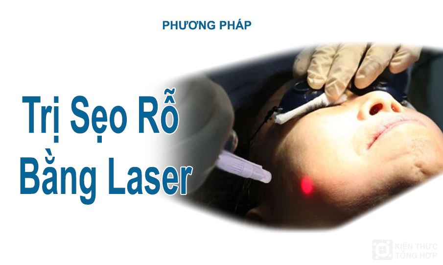 Trị sẹo rỗ bằng Laser