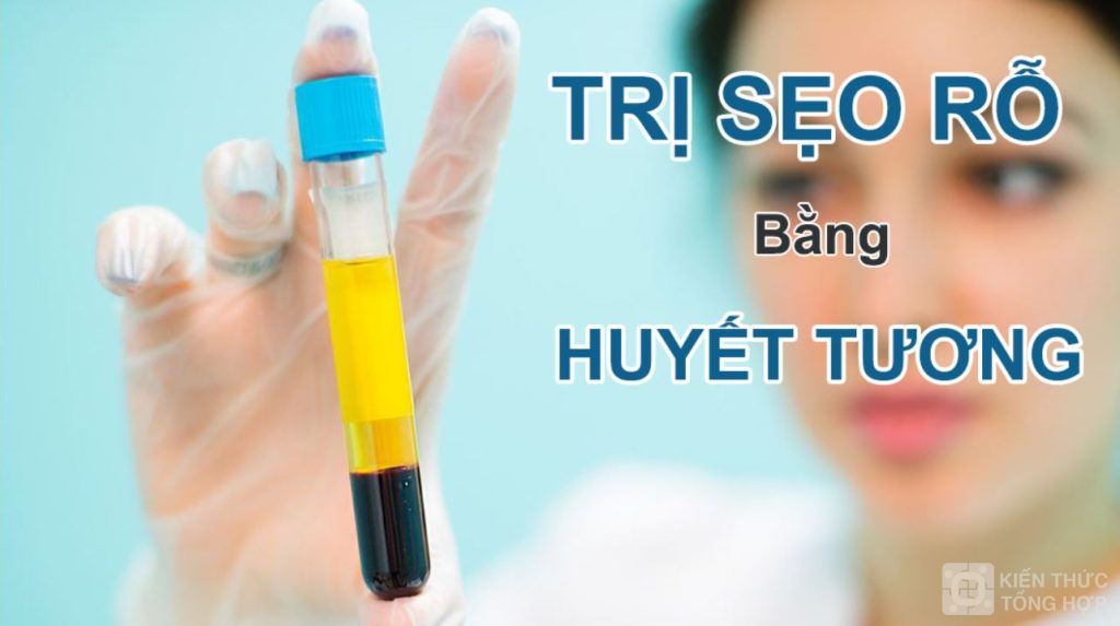 Dùng huyết tương để trị sẹo rỗ